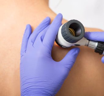 Dermatology