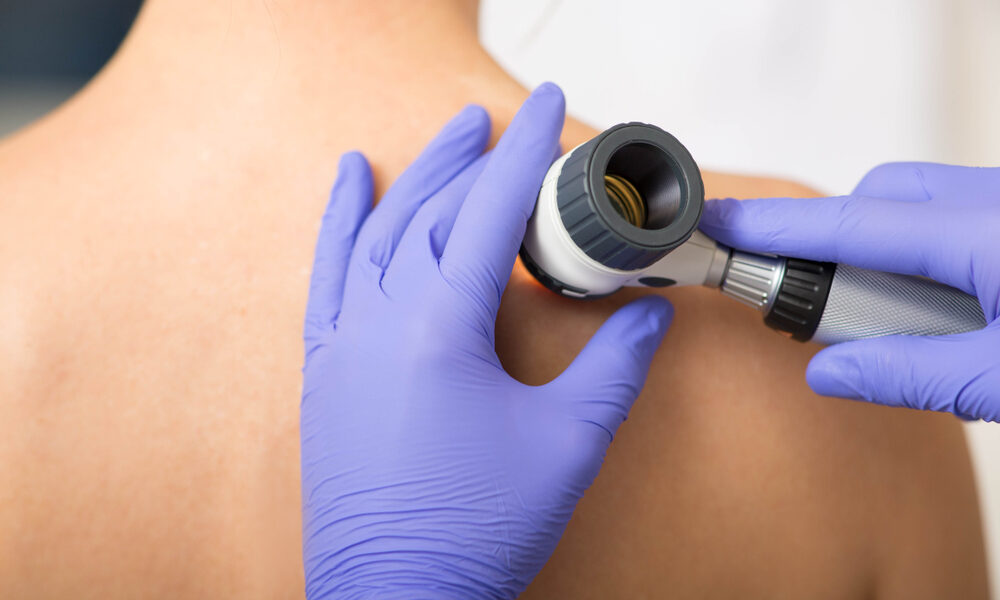 Dermatology